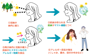 アレルギー反応発生のメカニズム